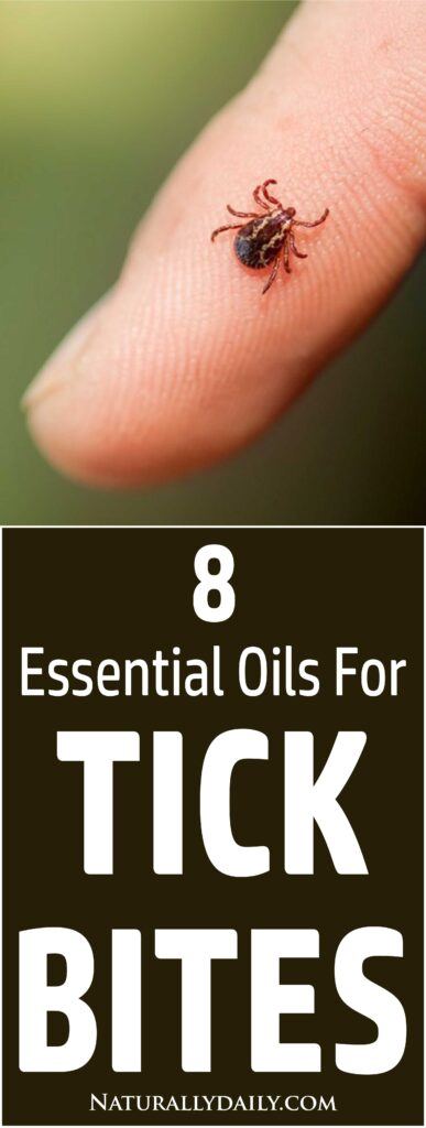 essential-oils-for-tick-bites(title-image)