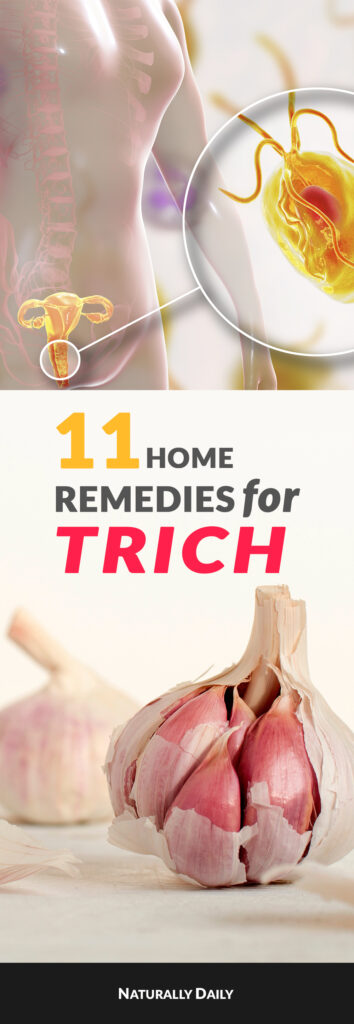 11-Home-Remedies-for-Trich(title-image)