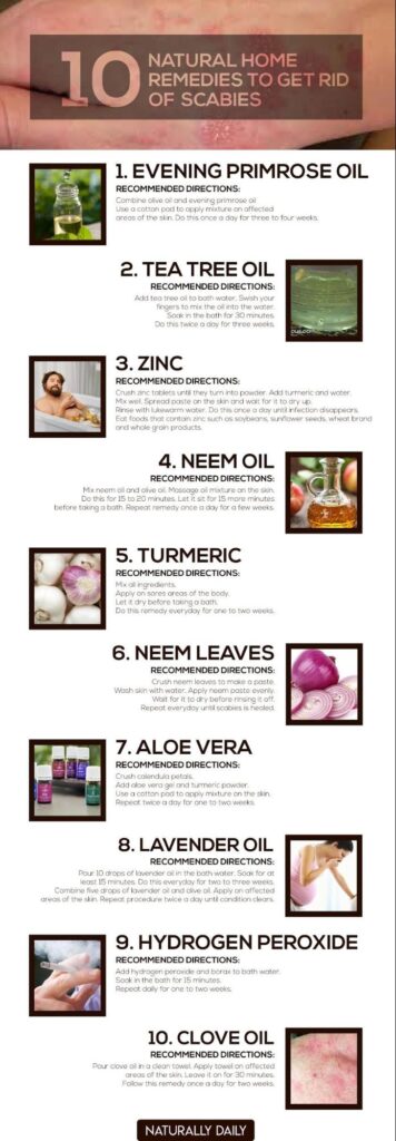 12-Home-Remedies-to-Get-Rid-of-Scabies-Naturally(infographic)