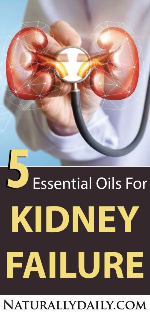 Essential-Oils-for-Kidney-Failure(title-image)