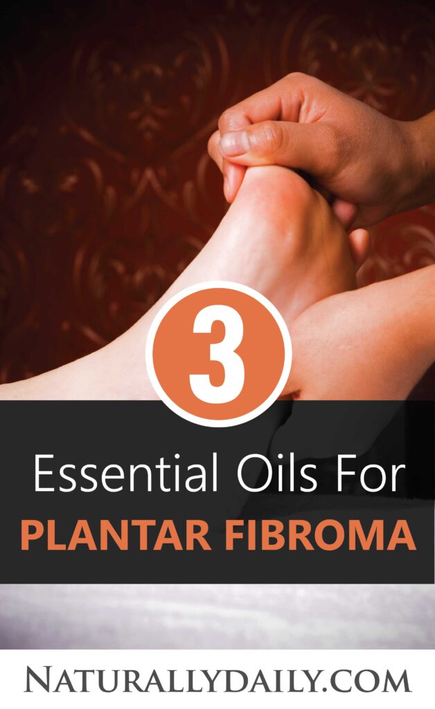 Best-Essential-Oils-for-Plantar-Fibroma(title-image)