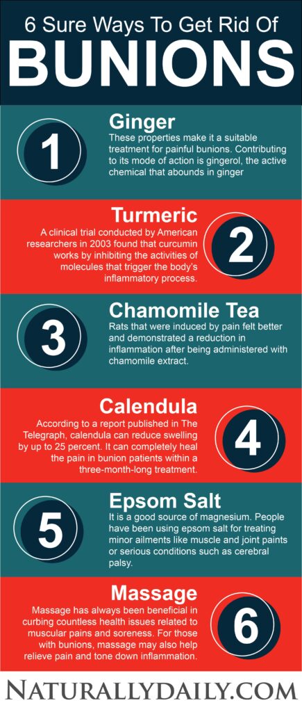 Sure-Ways-to-Get-Rid-of-Bunions-at-Home(infographic)