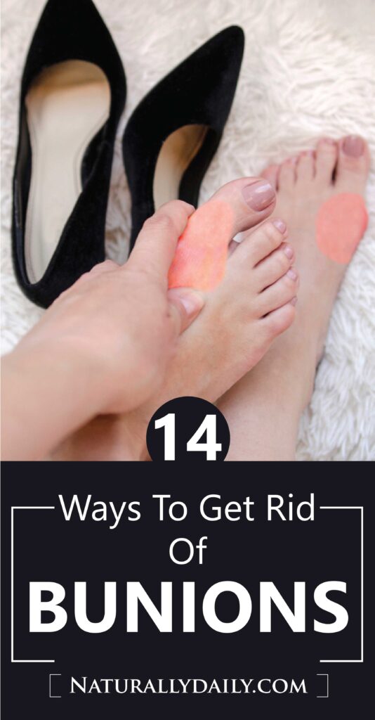 Sure-Ways-to-Get-Rid-of-Bunions-at-Home(title-image)