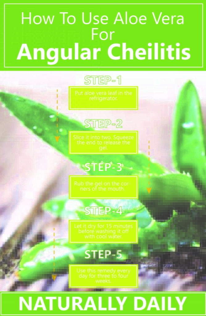 How to use aloevera for angular cheilitis