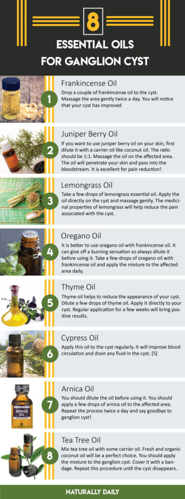 8-Best-Essential-Oils-for-Ganglion-Cyst-Natural-Treatment