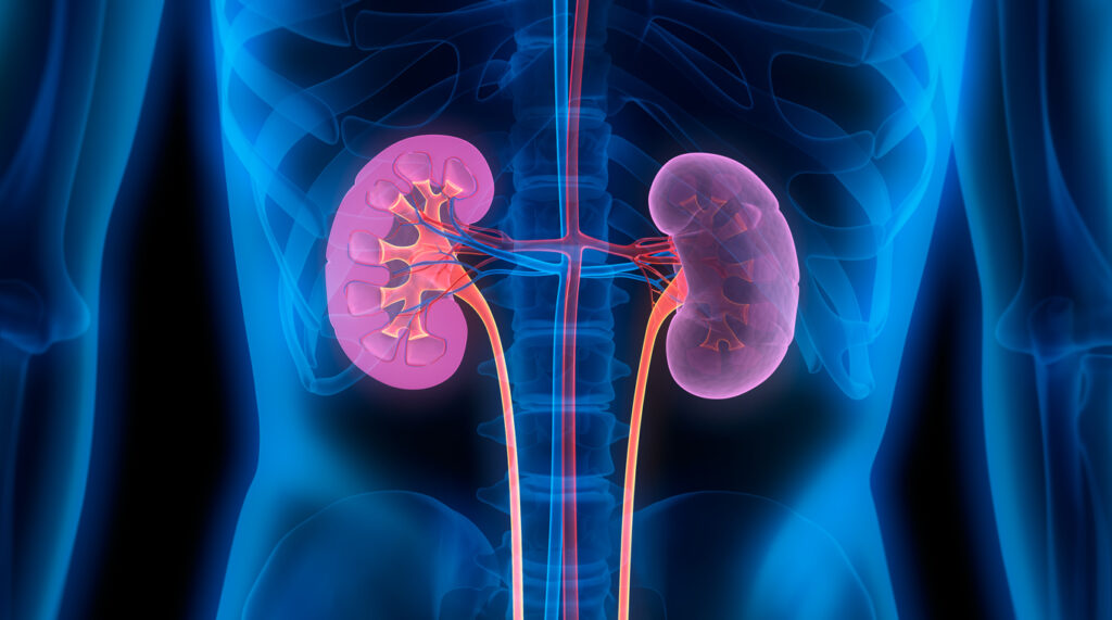 Home Remedies for Kidney Infection