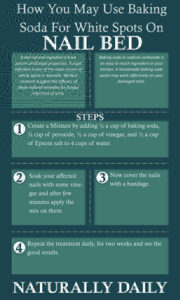 12-Natural-Home-Remedies-for-White-Spots-on-Toenails(infographic)