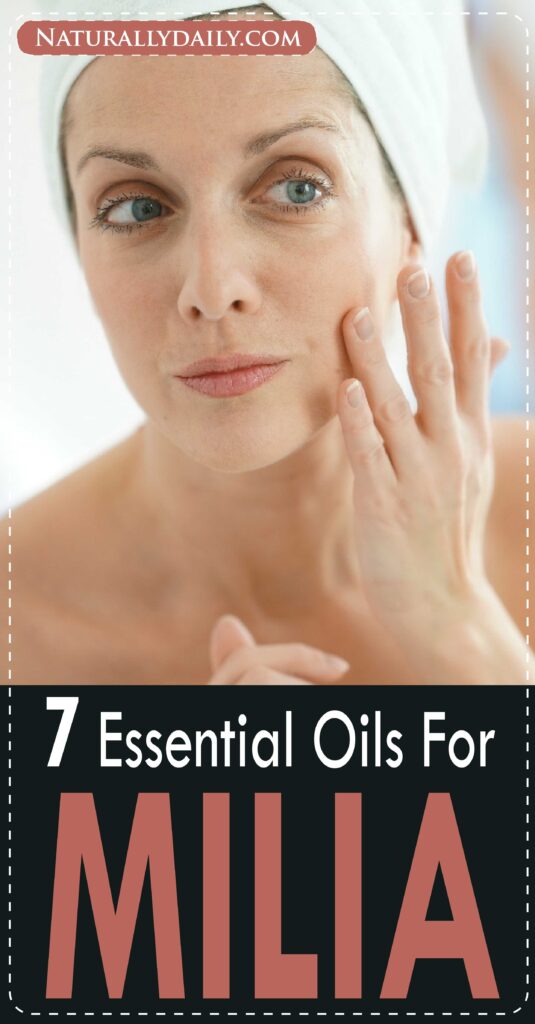 essential-oils-for-milia(title-image)