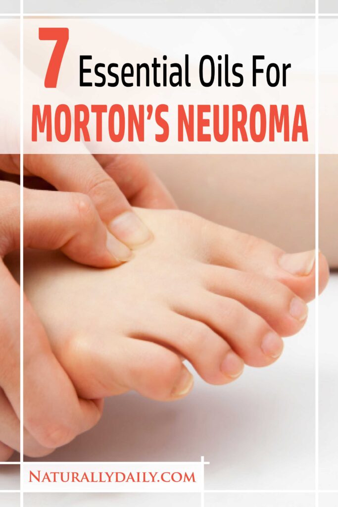 essential-oils-for-mortons-neuroma(title-image)