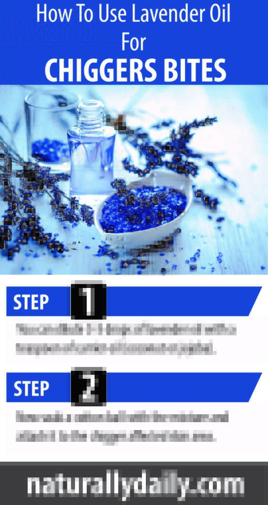How-to-use-lavender-oil-for-chiggers-bites(infographic)