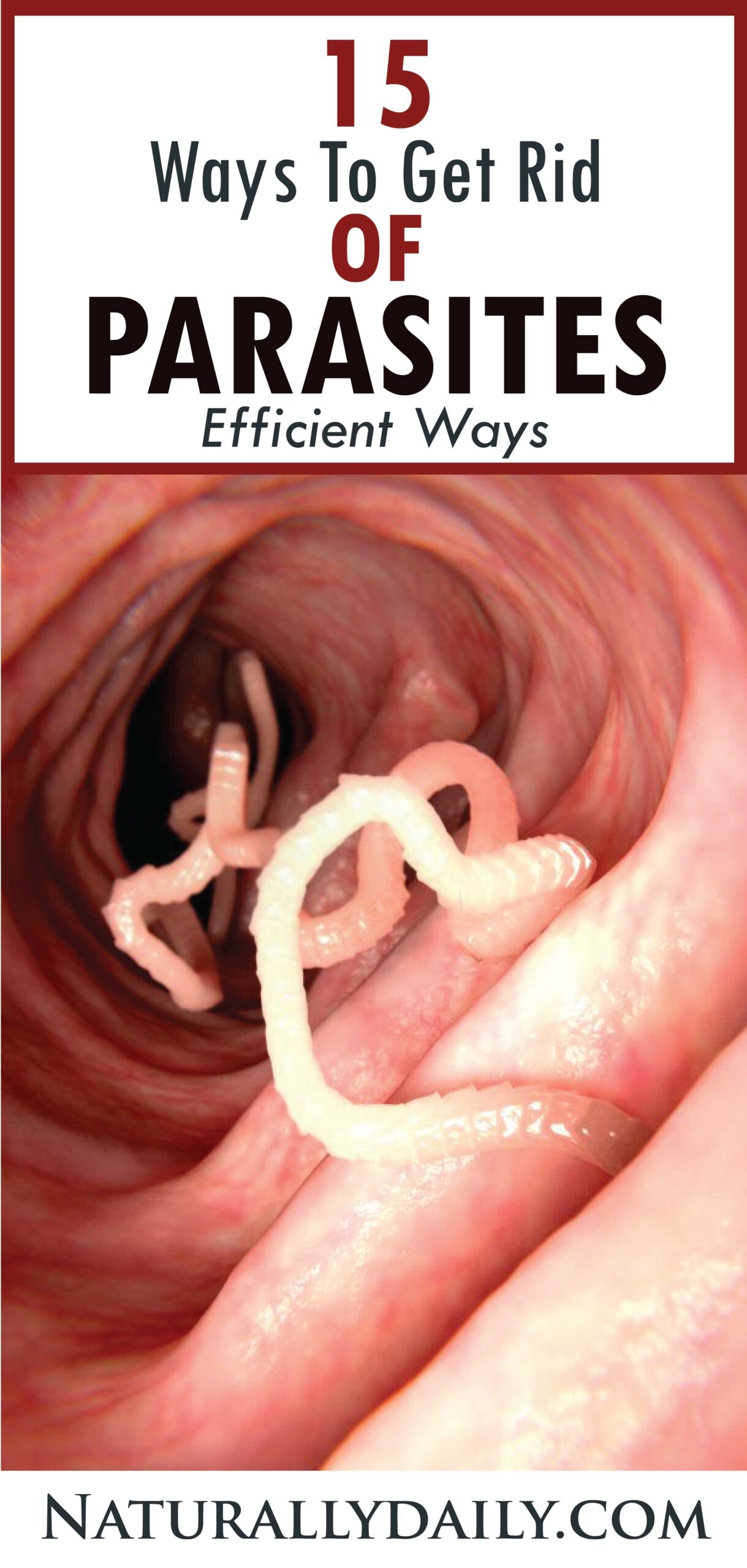 How to Get Rid of Parasites for Good 12 Efficient Ways Naturally Daily
