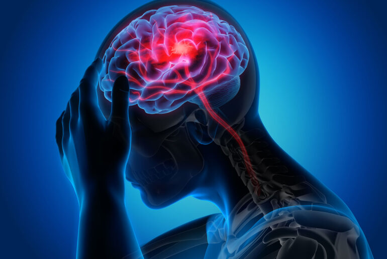Get Rid of Migraine