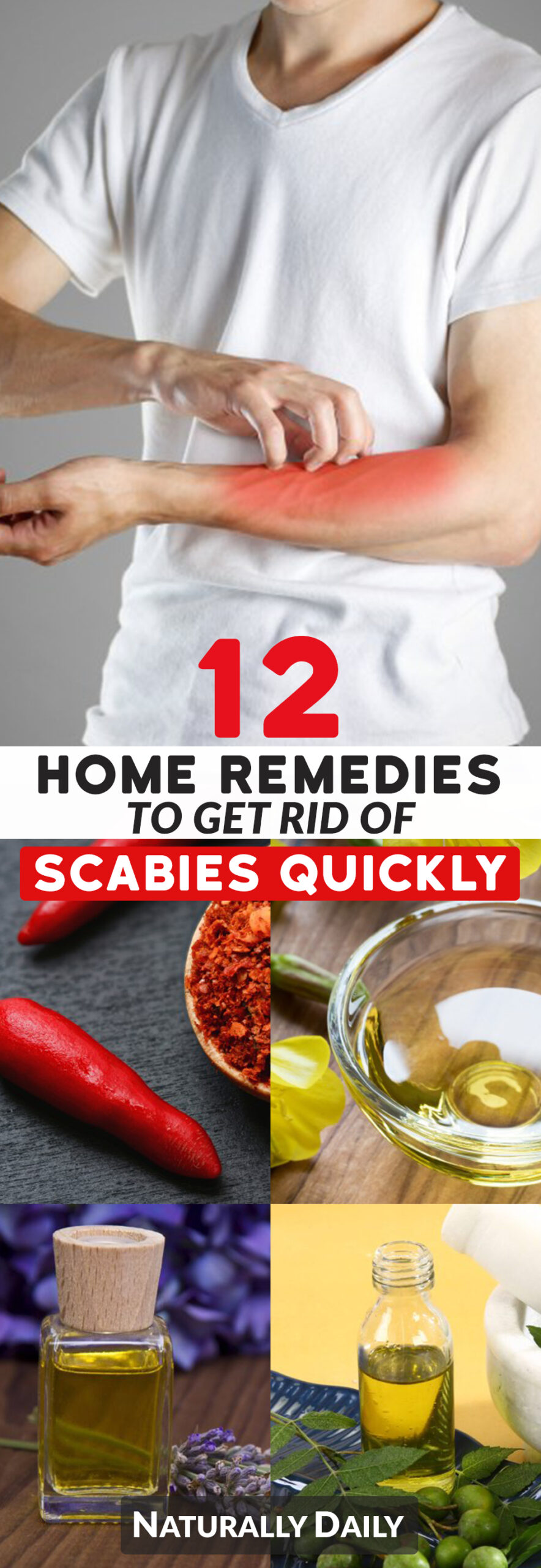 12 Home Remedies to Get Rid of Scabies Naturally Naturally Daily