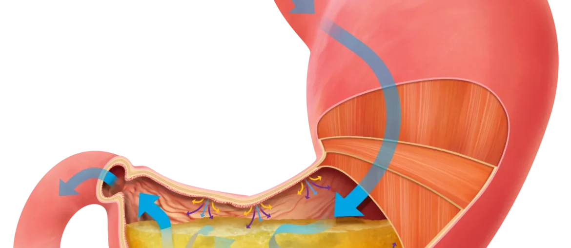 Cure Muscle Spasms in Stomach