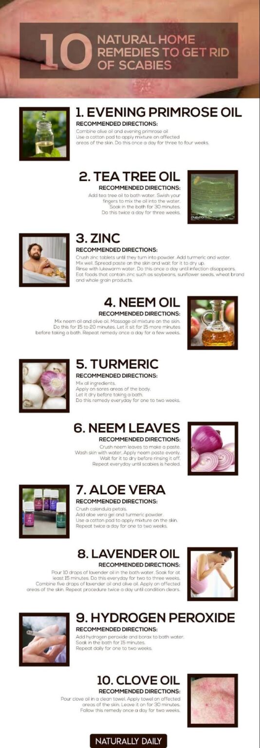 12 Home Remedies to Get Rid of Scabies Naturally Naturally Daily