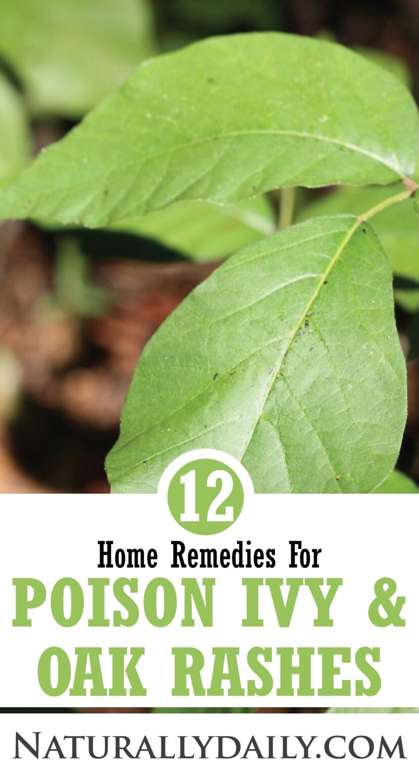 12 Home Remedies for Poison Ivy and Oak Rashes with Useful Tips ...