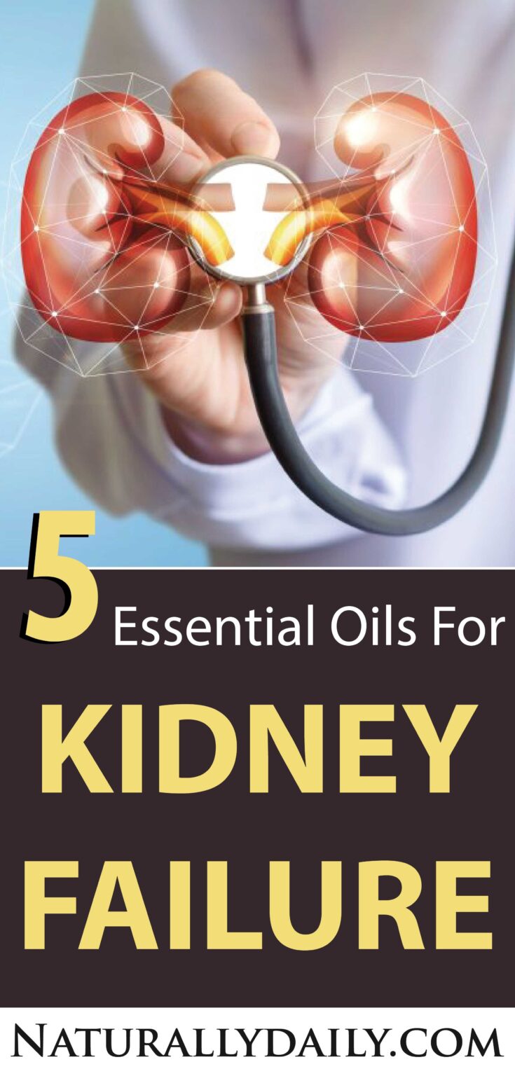 Essential Oils for Kidney Failure Do They Really Work?