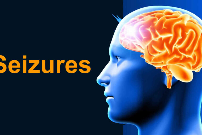 Essential Oils for Seizures