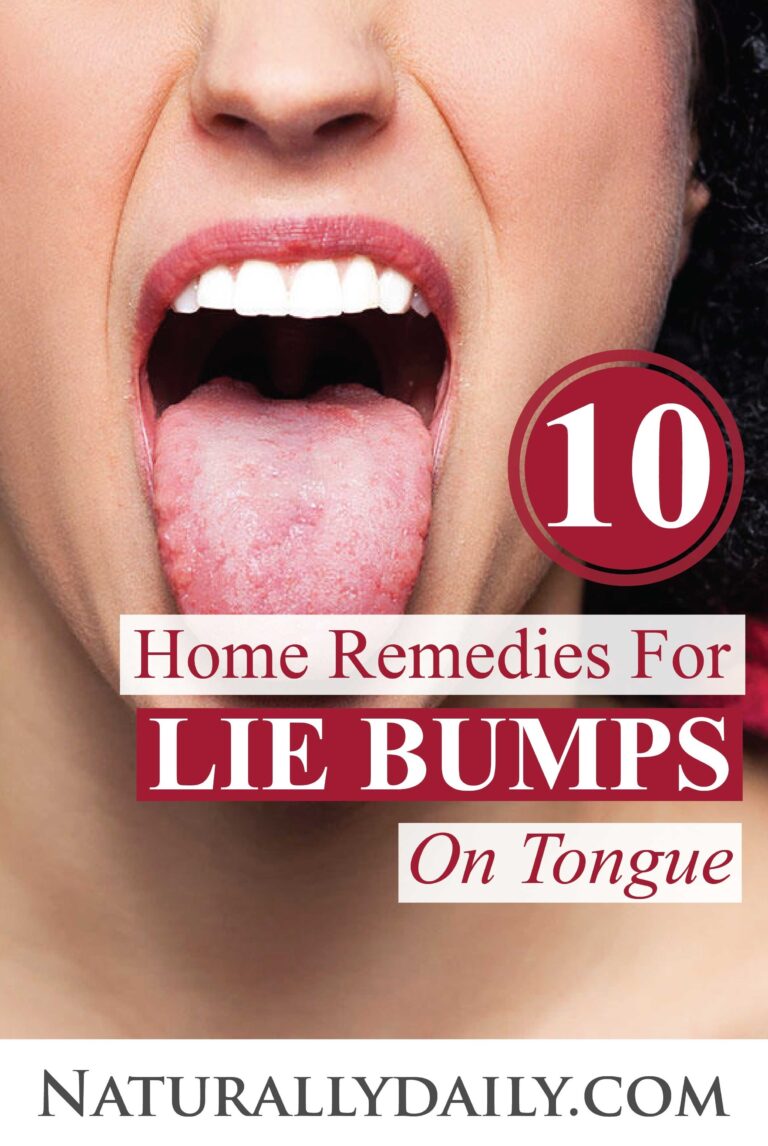 How Do You Get A Lie Bump On Your Tongue