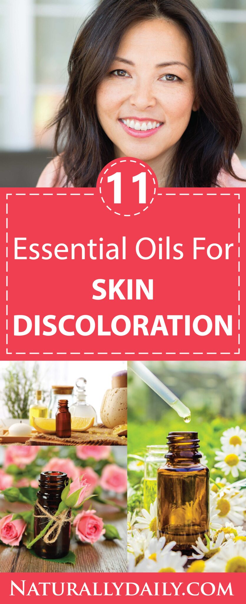 Top 11 Essential Oils for Skin Discoloration, Hyperpigmentation, & Melasma