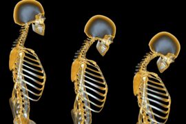 Essential Oils for Osteoporosis