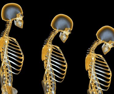 Essential Oils for Osteoporosis