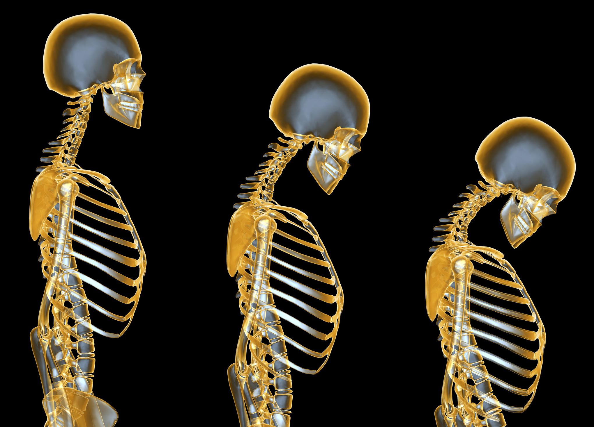 essential oils for osteoporosis