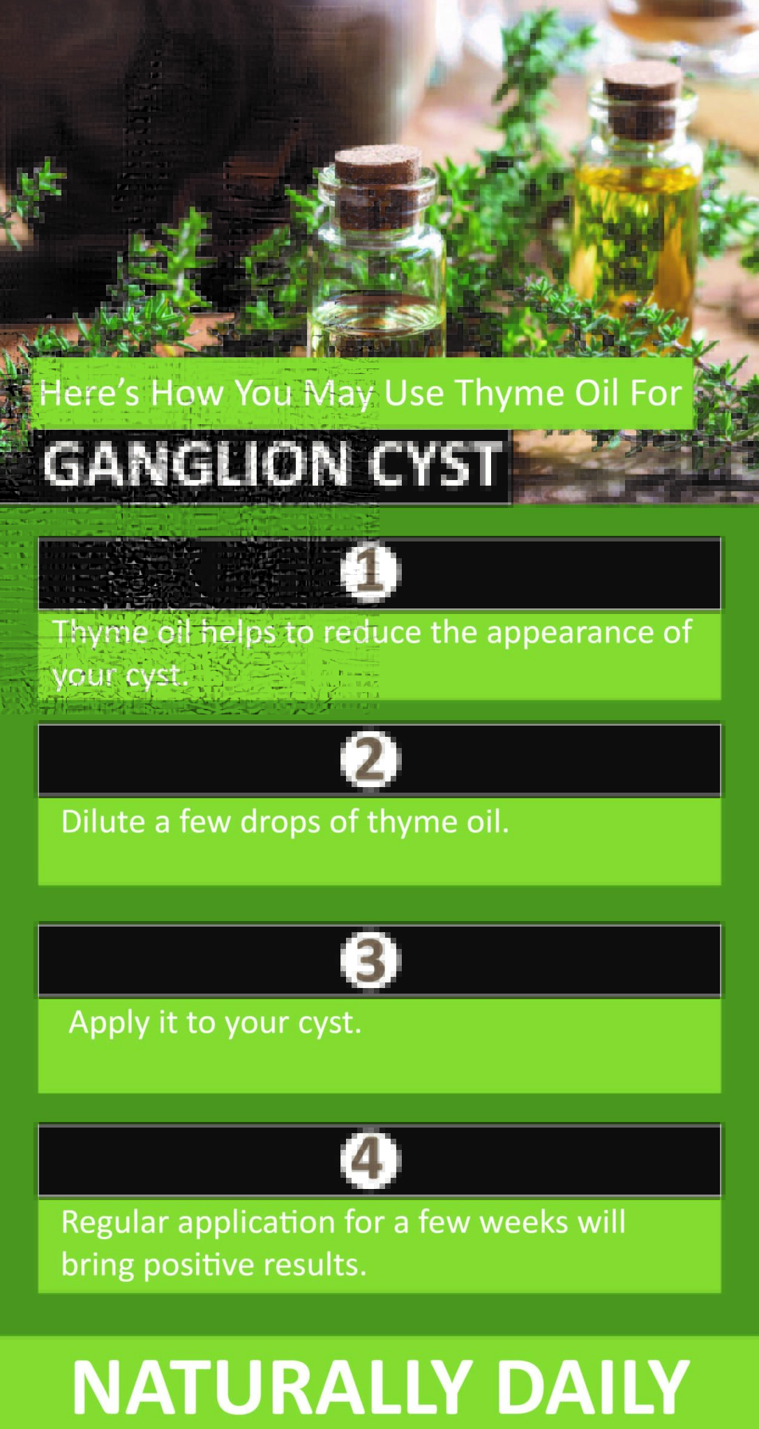 8 Essential Oils for Ganglion Cyst and How to Use Them
