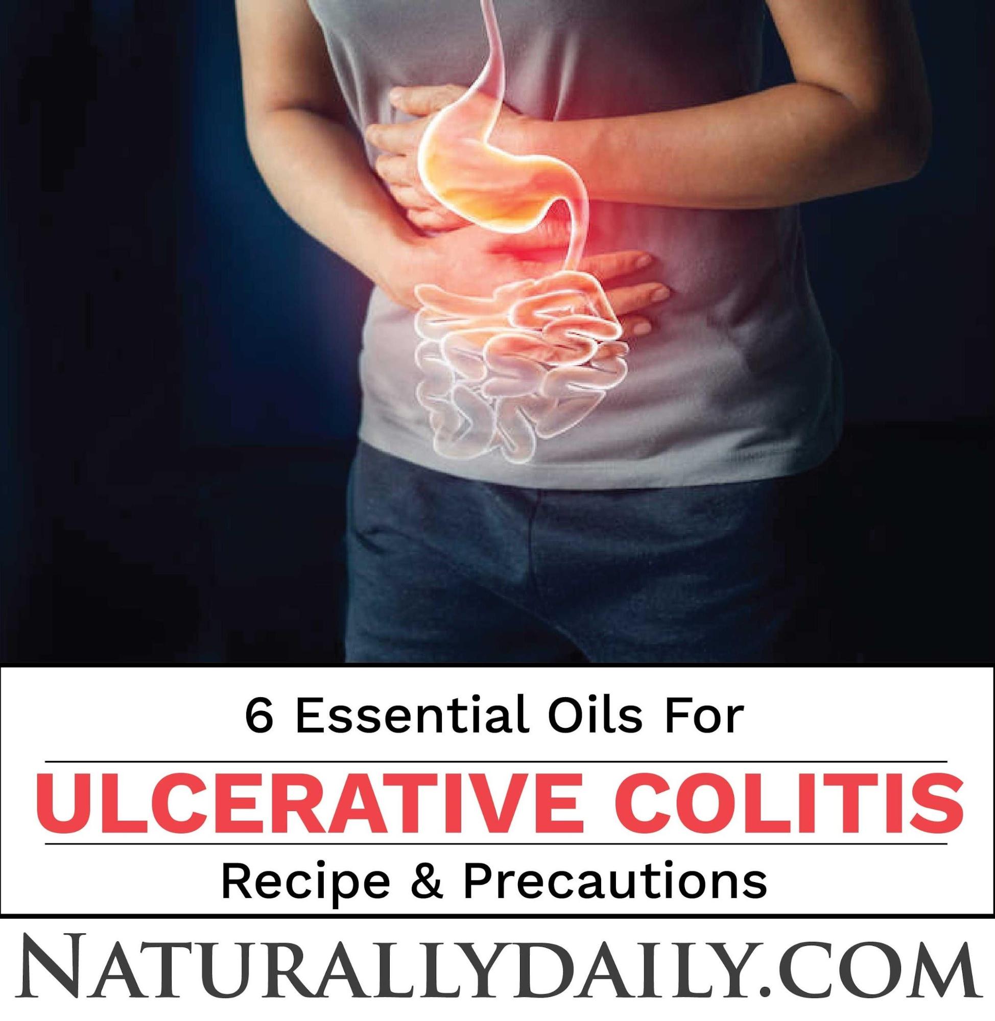 6 Essential Oils for Ulcerative Colitis Remedies and Precautions