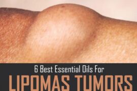 6-Best-Essential-Oils-for-Lipomas-Tumors