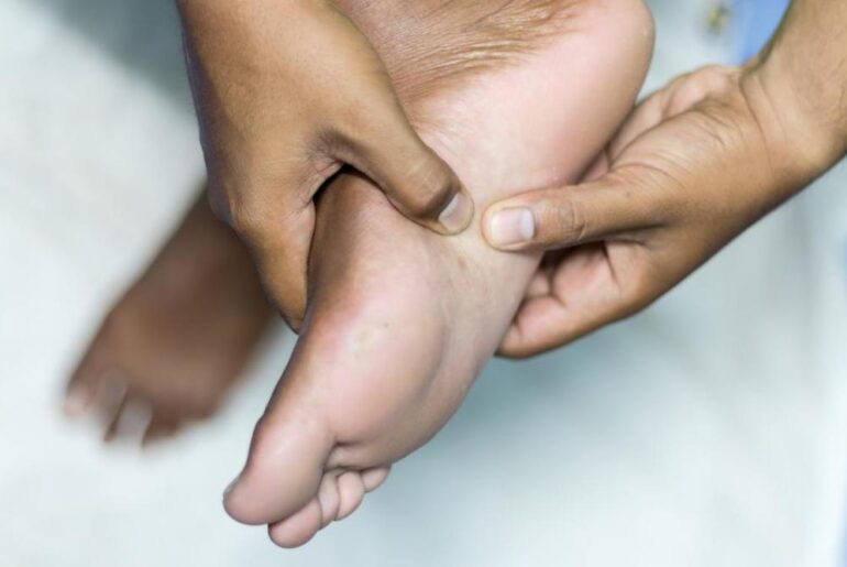 Best-Essential-Oils-for-Plantar-Fibroma