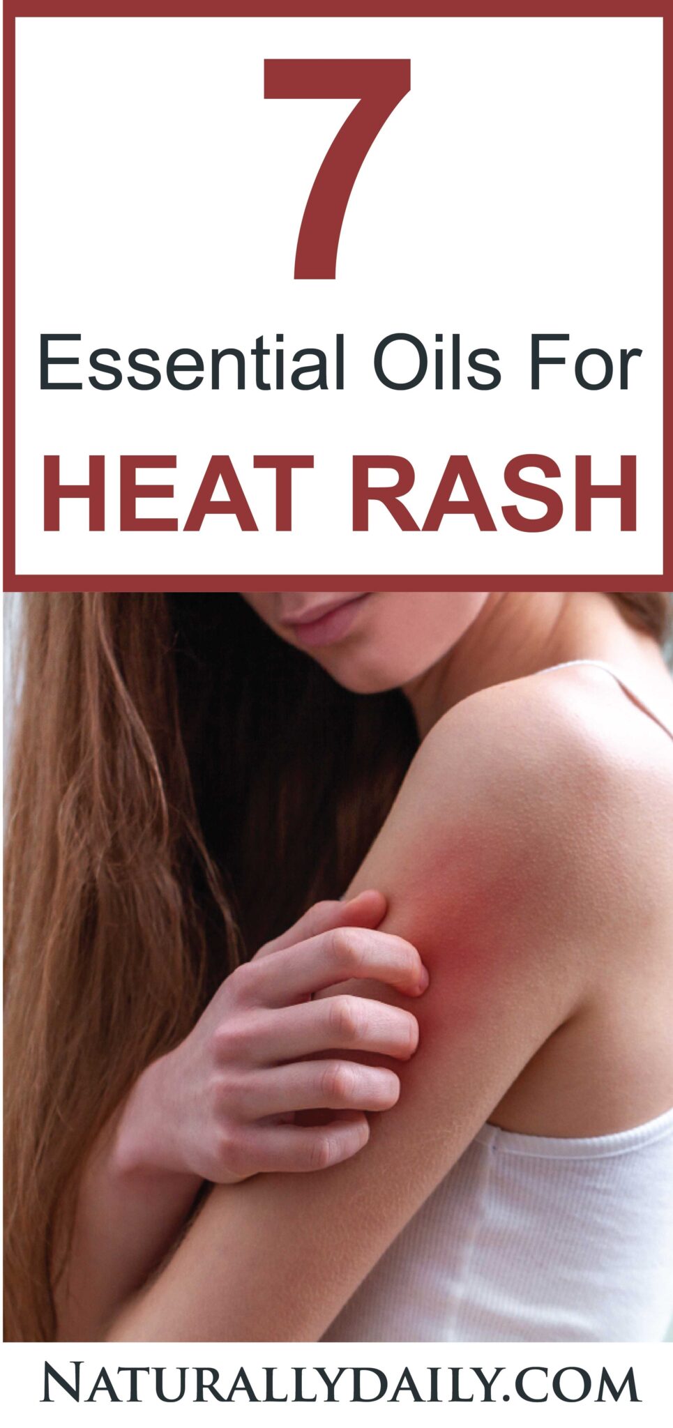 7 Best Essential Oils for Heat Rash Causes & Remedies