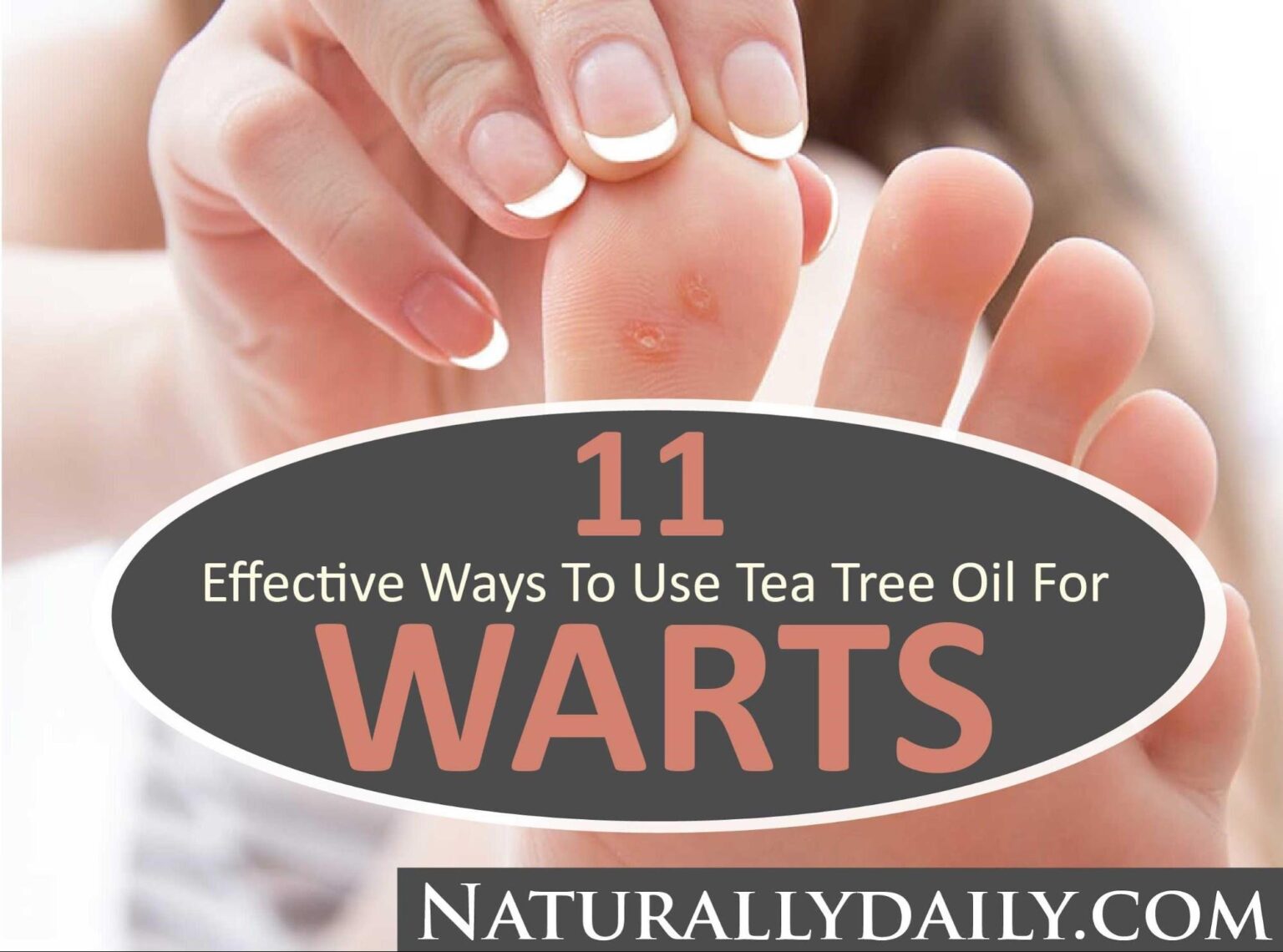 Tea Tree Oil for Warts: 11 Effective Ways to Use