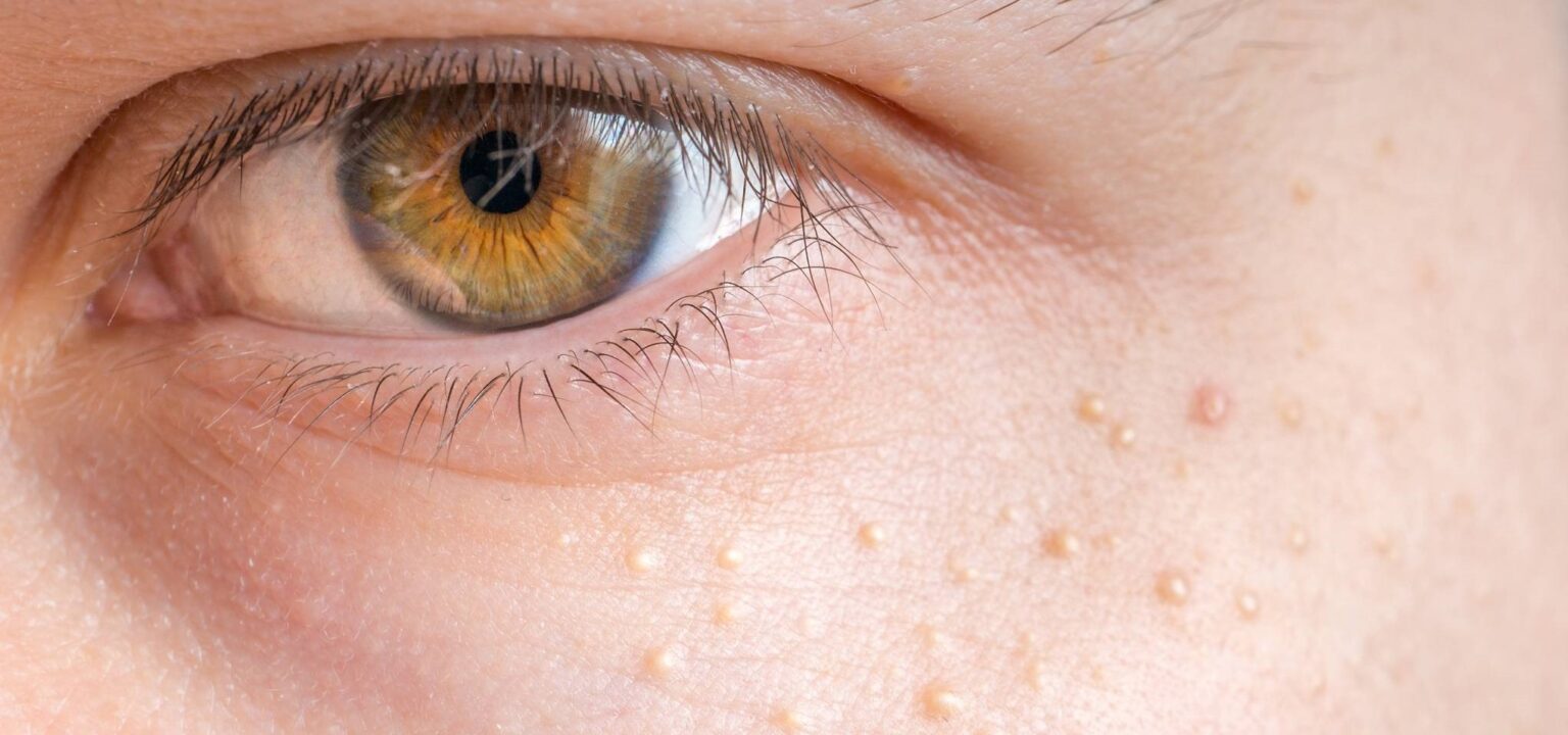 Essential Oils for Kidney Failure Do They Really Work?