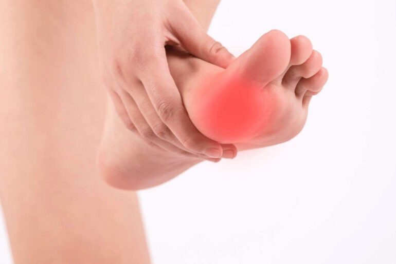 Essential Oils for Morton's Neuroma
