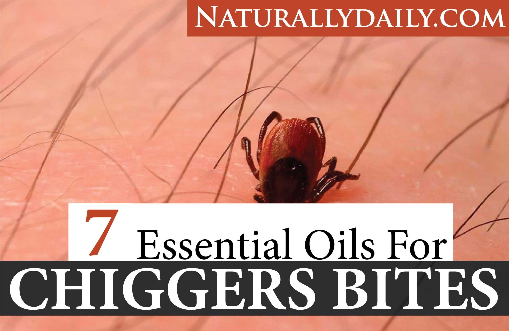 7 Essential Oils for Chiggers Bites: to Relieve Itch and Rash