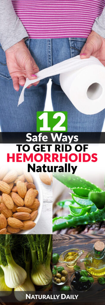 12 Safe Ways To Get Rid Of Hemorrhoids Naturally Naturally Daily 5093